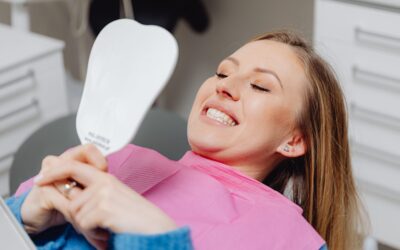 Veneers Cost: What to Expect